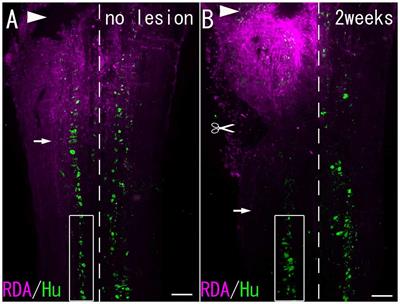 Chondroitin Sulfate Expression in Perineuronal Nets After Goldfish Spinal Cord Lesion